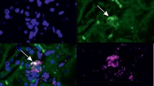 Las células Noren, fabricantes de EPO, descubiertas en el estudio, están marcadas con flechas blancas. 
