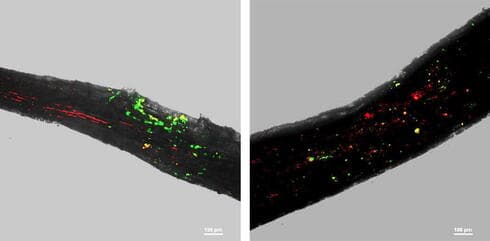 Las imágenes de fluorescencia y campo claro revelan que durante la sequía, a la izquierda, la raíz de un árbol está más densamente colonizada por dos bacterias beneficiosas. (Instituto Weizmann de Ciencias) Las imágenes de fluorescencia y campo claro revelan que durante la sequía, a la izquierda, la raíz de un árbol está más densamente colonizada por dos bacterias beneficiosas.