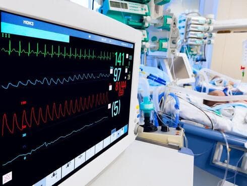 Aparato de electrocardiograma.