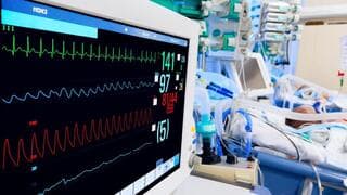 Aparato de electrocardiograma.