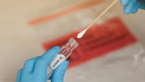 Prueba contra el COVID-19. 