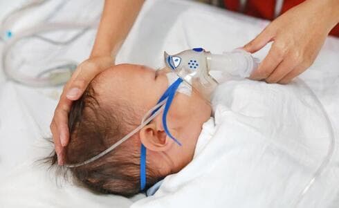 Los bebés son afectados por bronquiolitis y suelen necesitar hospitalización. (Shutterstock) Los bebés son afectados por bronquiolitis y suelen necesitar hospitalización.