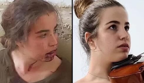 Agam Berger, antes y después de su secuestro en Gaza.