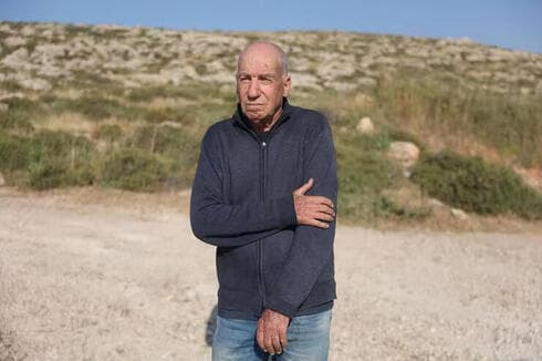Shaul Golan tras ser atacado. 