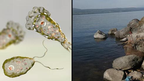 Nagallery Paulari, la ameba que penetró en el cuerpo del joven aparentemente en el Mar de Galilea. 