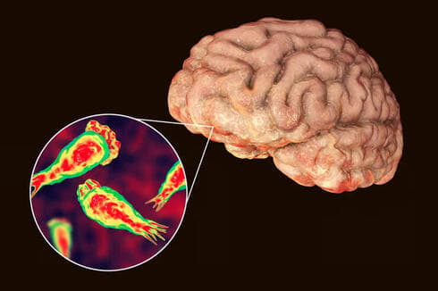 Naegleria fowleri, según su nombre científico, popularmente conocida como "ameba comecerebros". 