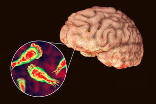 Naegleria fowleri, según su nombre científico, popularmente conocida como "ameba comecerebros". 