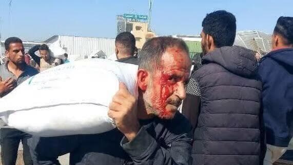 Palestino herido se lleva un saco de harina