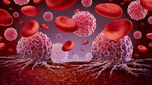 Una nueva esperanza para el diagnóstico de los procesos tempranos de la leucemia. (Shutterstock) Una nueva esperanza para el diagnóstico de los procesos tempranos de la leucemia.