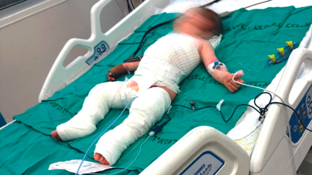 "זה יכול היה להיגמר במוות". הפעוט א' בבית החולים