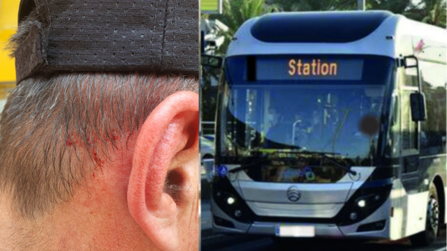 הפקח שהותקף
