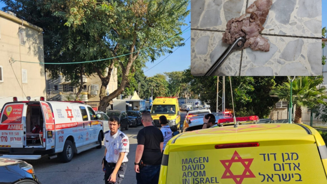 נחנק באמצע הארוחה
