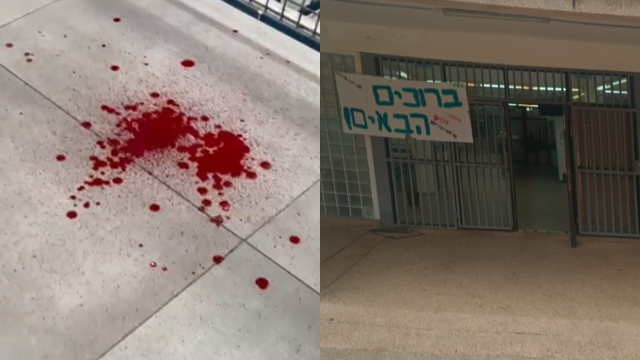 תקיפה אלימה וסימני דם בבית ספר בחיפה