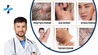 הורדת שומות 