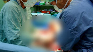 عملية ولادة صورة توضيحية