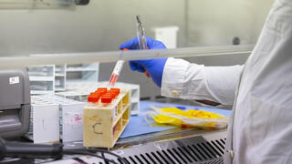 فحص دم في مختبر طبي