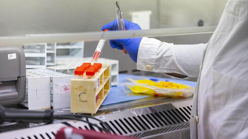 فحص دم في مختبر طبي