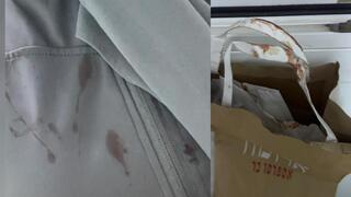آثار الدماء بعد الاعتداء