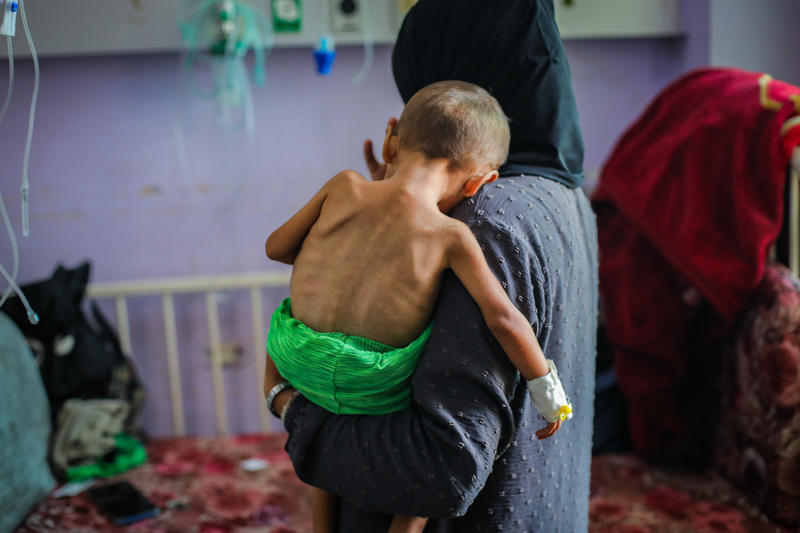 معاناة ومأساة انسانية متفاقمة في غزة