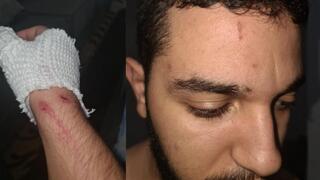 اعتداء عنصري بحق شاب من أم الفحم 