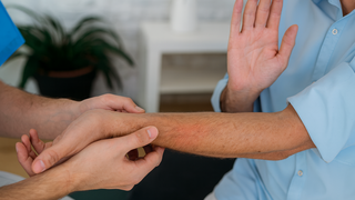 أمراض الجلد صورة توضيحية 