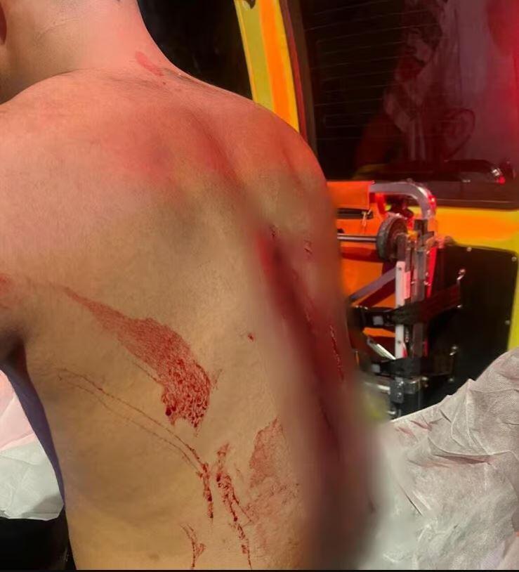 طعن عامل في حولون