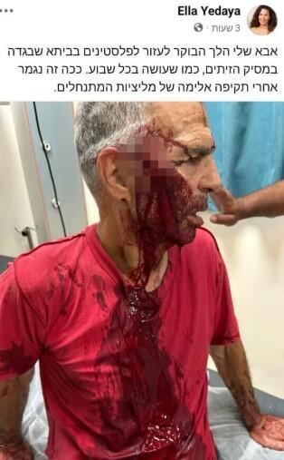 مستوطنون يهاجمون فلسطينيين وصحفيين خلال قطف الزيتون في الضفة