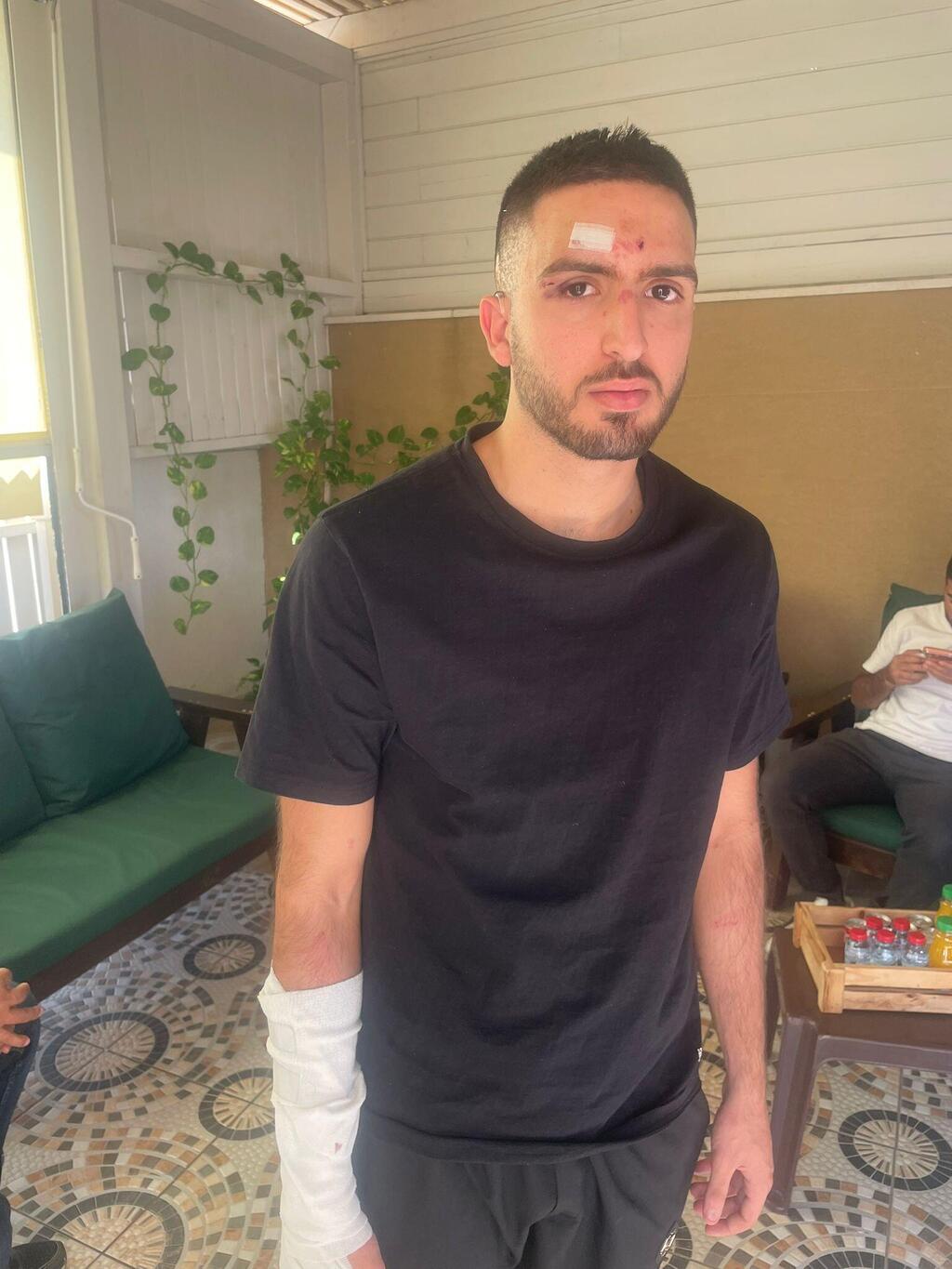 أحد العاملين في مطعم اميغوس الذي تعرض لاعتداء من مشجعي مكابي حيفا (وفق البند 27 أ من قانون الحقوق الأدبية (2007)) أحد العاملين في مطعم اميغوس الذي تعرض لاعتداء من مشجعي مكابي حيفا