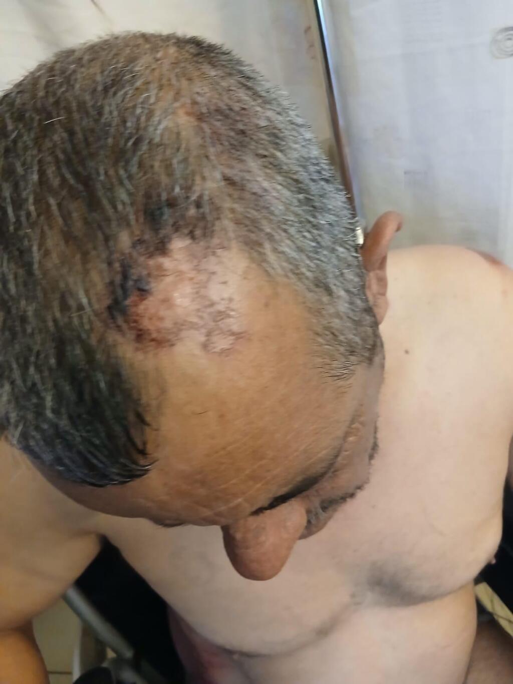 نشأت جبارين: "تعرّضت لاعتداء وحشي بدوافع عنصرية وكنت معلّقًا على السيارة لمسافة طويلة"