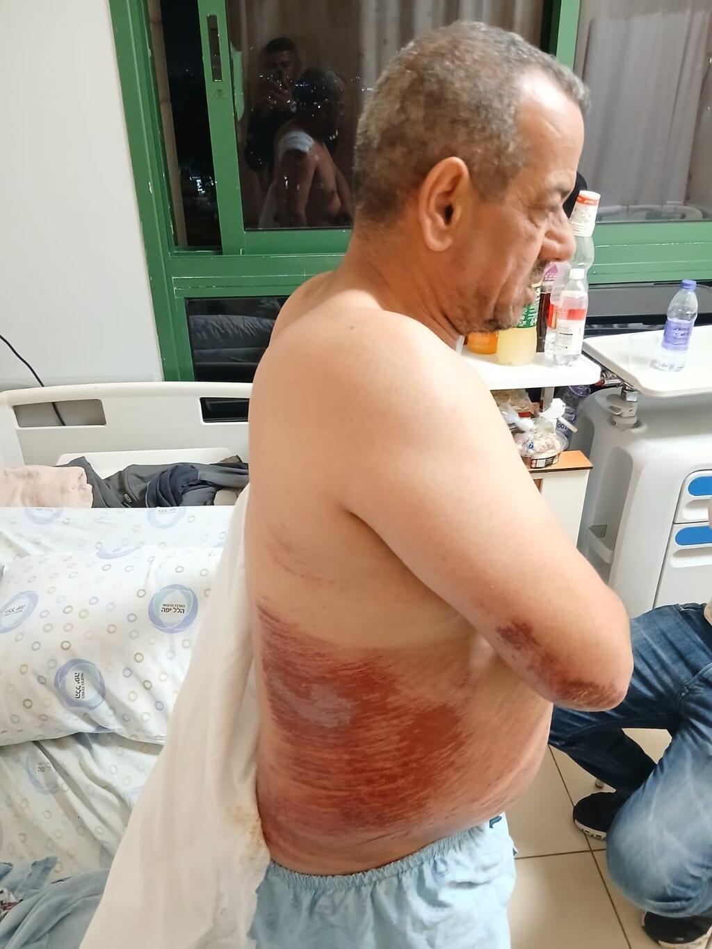 نشأت جبارين: "تعرّضت لاعتداء وحشي بدوافع عنصرية وكنت معلّقًا على السيارة لمسافة طويلة"