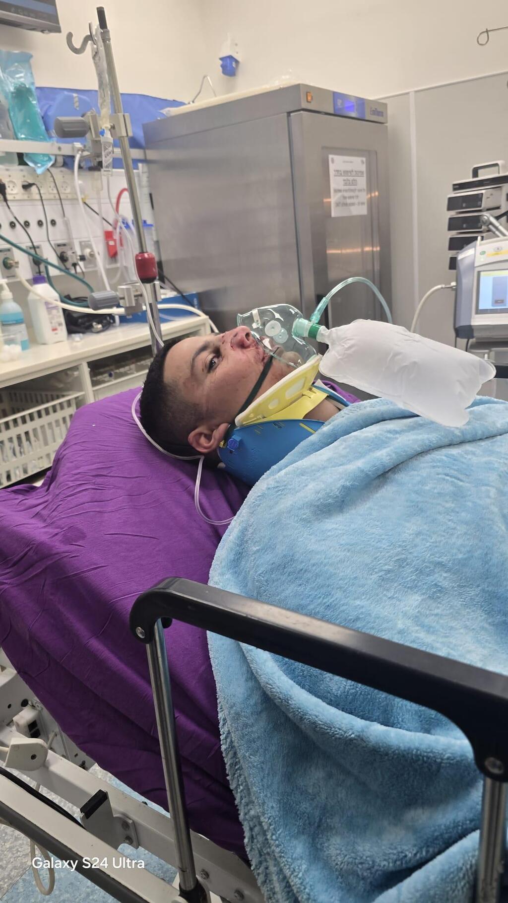 فتى من عرابة يرقد في المستشفى إثر حادث طرق والعائلة تتهم الشرطة بالتسبب بالحادث