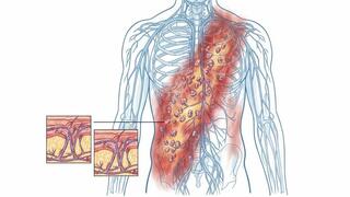 الحزام الناري