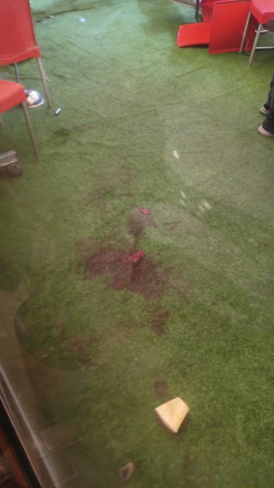 إصابة رئيس بلدية عرابة ورئيس اللجنة الشعبية في إطلاق نار (استخدام الصورة وفقا لبند 27أ) إصابة رئيس بلدية عرابة ورئيس اللجنة الشعبية في إطلاق نار