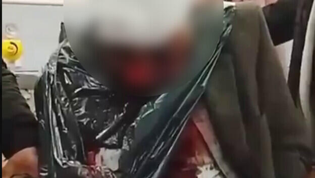 اعتداء على مسنّ فلسطيني قرب نابلس واعتقال مستوطنين مشتبهين بالحادثة