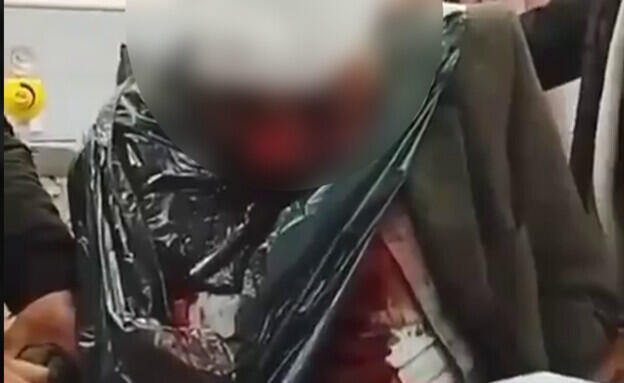 اعتداء على مسنّ فلسطيني قرب نابلس (وفق البند 27 أ من قانون الحقوق الأدبية (2007)) اعتداء على مسنّ فلسطيني قرب نابلس واعتقال مستوطنين مشتبهين بالحادثة