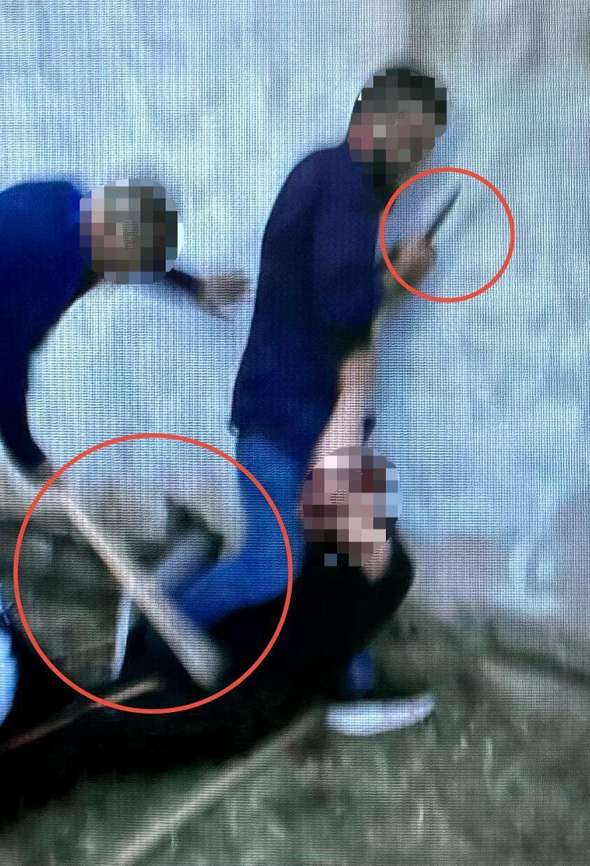 اعتداء في شفاعمرو