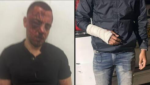 الاعتداء على شبان من دير الأسد في بئر السبع