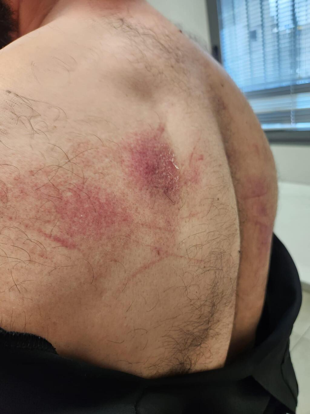 اعتداء واعتقال في كفر ياسيف: عصام شريف يروي تفاصيل ليلة قاسية مع الشرطة (وفقا اللمادة 27أ) اعتداء واعتقال في كفر ياسيف: عصام شريف يروي تفاصيل ليلة قاسية مع الشرطة