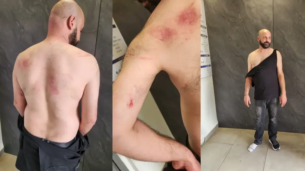 اعتداء واعتقال في كفر ياسيف: عصام شريف يروي تفاصيل ليلة قاسية مع الشرطة (وفقا للمادة 27أ) اعتداء واعتقال في كفر ياسيف: عصام شريف يروي تفاصيل ليلة قاسية مع الشرطة