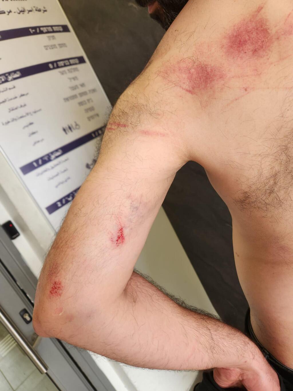 اعتداء واعتقال في كفر ياسيف: عصام شريف يروي تفاصيل ليلة قاسية مع الشرطة (وفقا اللمادة 27أ) اعتداء واعتقال في كفر ياسيف: عصام شريف يروي تفاصيل ليلة قاسية مع الشرطة