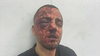 المحامي ناصر نعمة بعد اعتداء الشرطة عليه