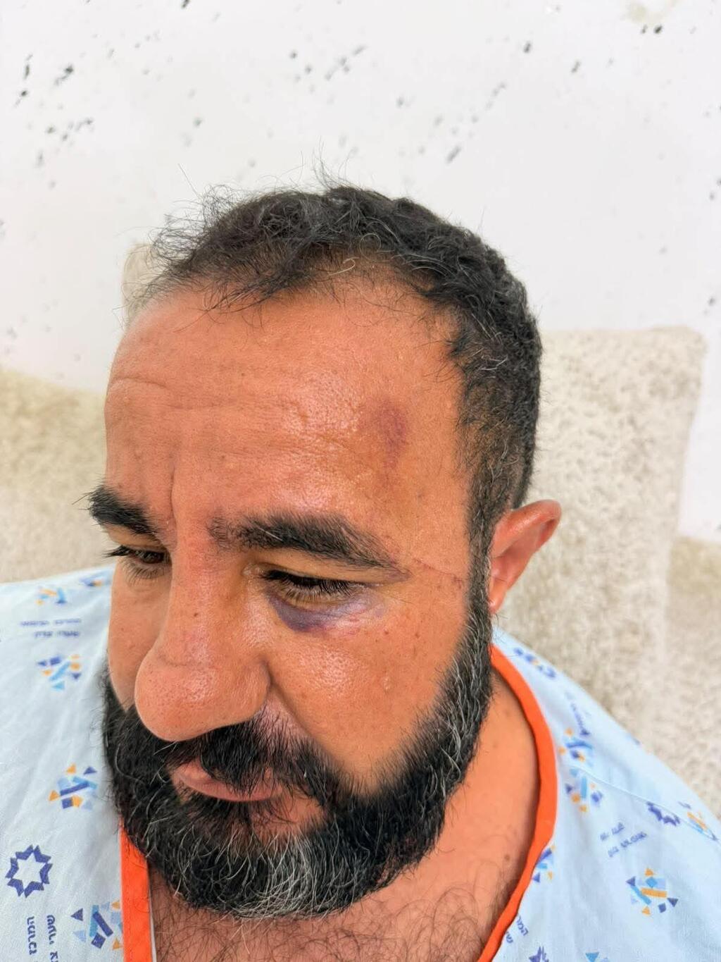 مستوطنون يعتدون على مقدسي وأبنائه خلال قطف الزيتون والشرطة تعتقله وهو مصاب