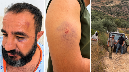 مستوطنون يعتدون على مقدسي وأبنائه خلال قطف الزيتون والشرطة تعتقله وهو مصاب