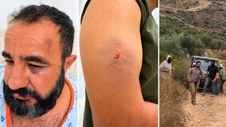 مستوطنون يعتدون على مقدسي وأبنائه خلال قطف الزيتون والشرطة تعتقله وهو مصاب