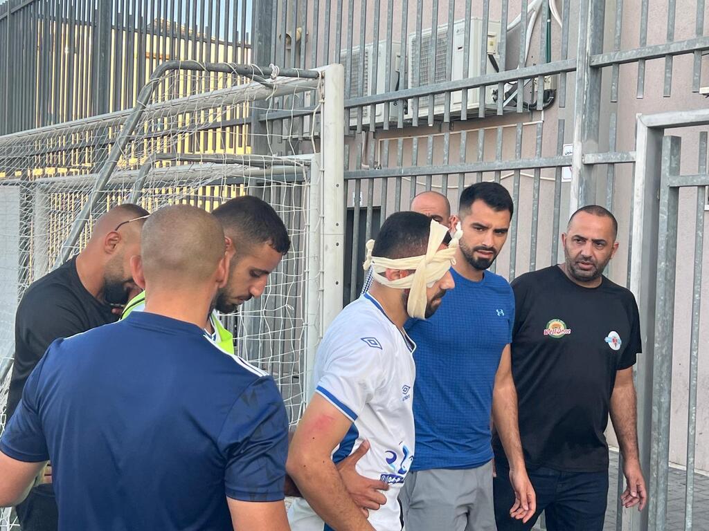 إصابة لاعب هبوعيل جت أكرم عسلي (راديو الناس) إصابة لاعب هبوعيل جت أكرم عسلي